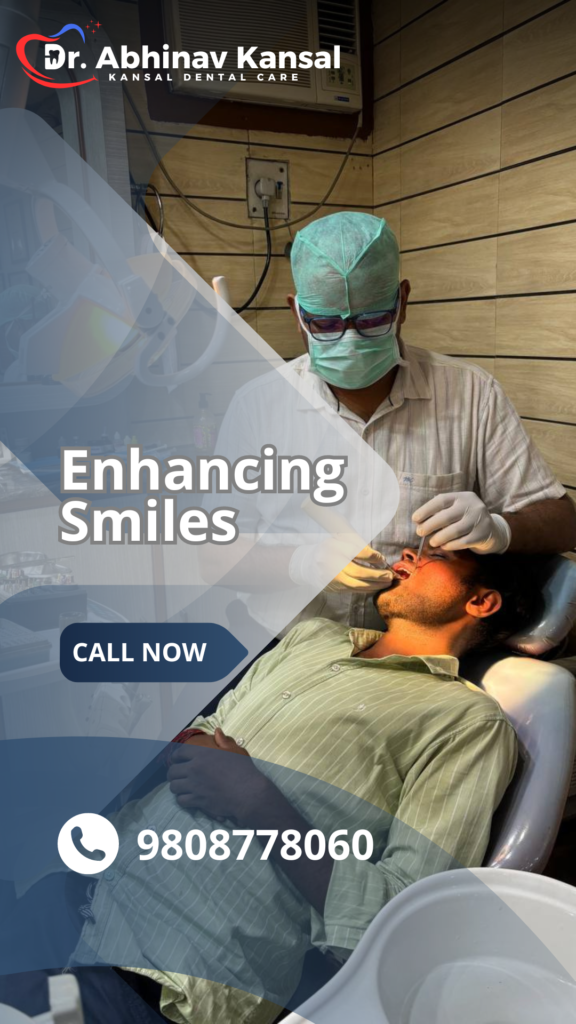 enhancing smiles at dr abhinav kansal dentistry